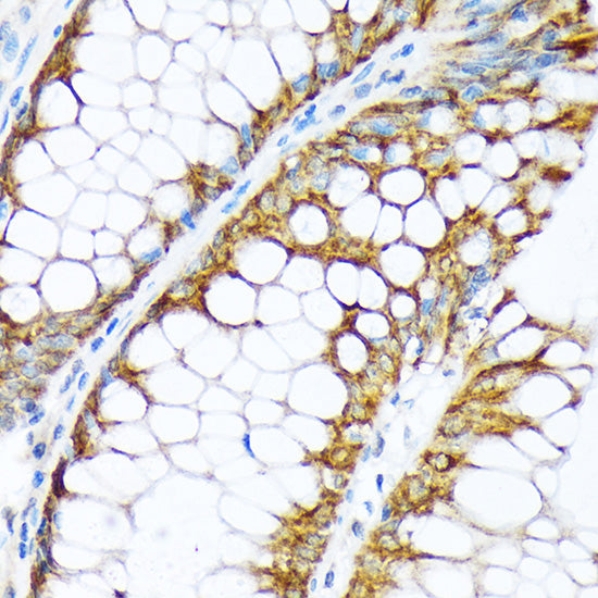 ENTPD5 Rabbit mAb