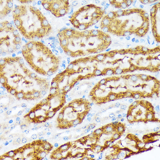 ENTPD5 Rabbit mAb