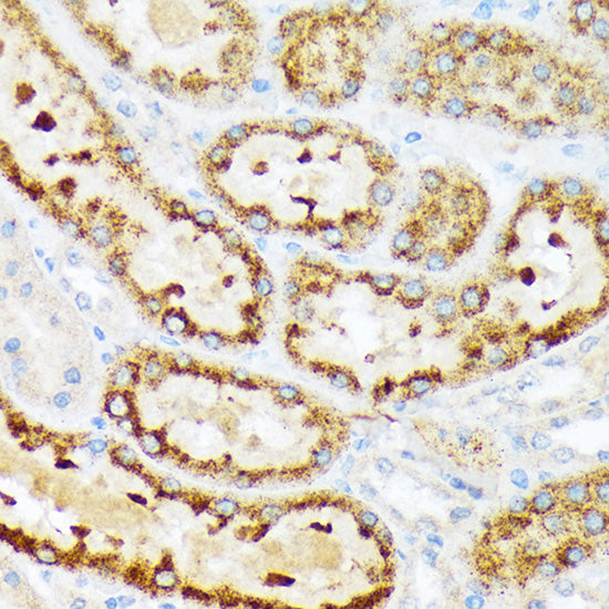 ENTPD5 Rabbit mAb