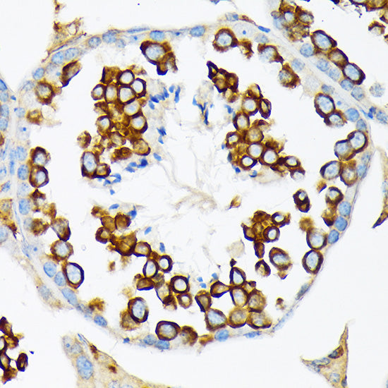 Calmegin Rabbit mAb