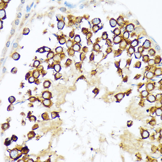 Calmegin Rabbit mAb