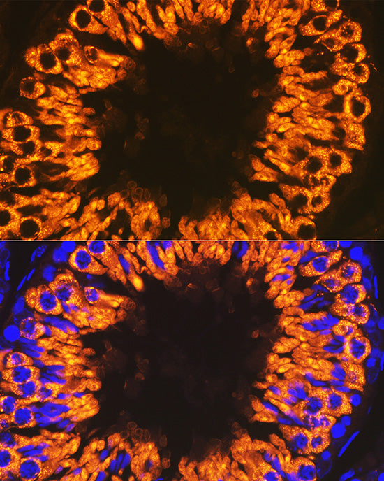 Calmegin Rabbit mAb