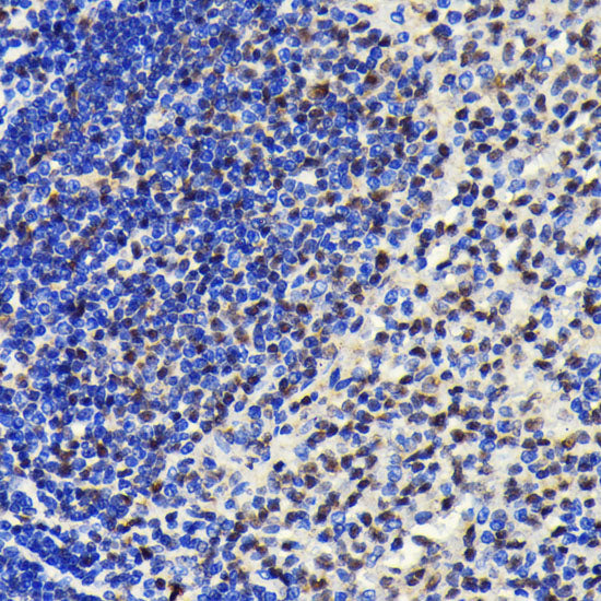 SP1 Rabbit mAb