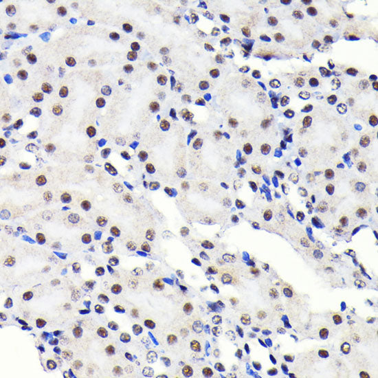 SP1 Rabbit mAb