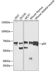 p63 Rabbit mAb