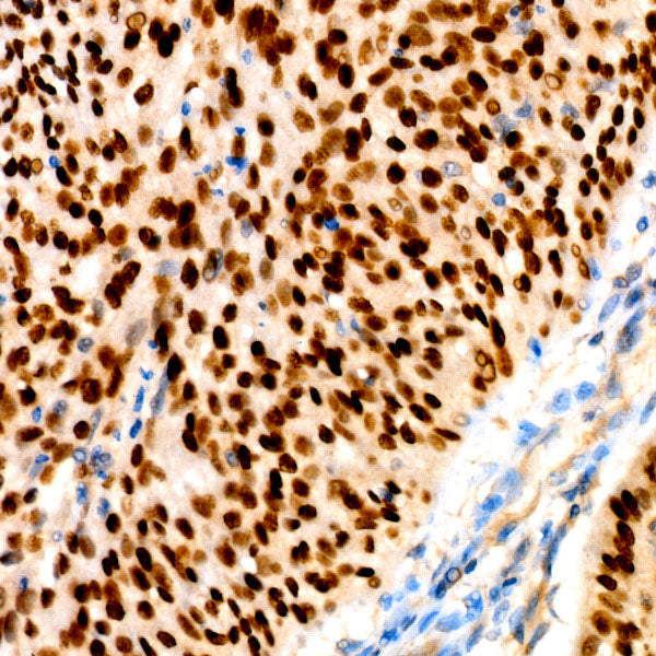 p63 Rabbit mAb