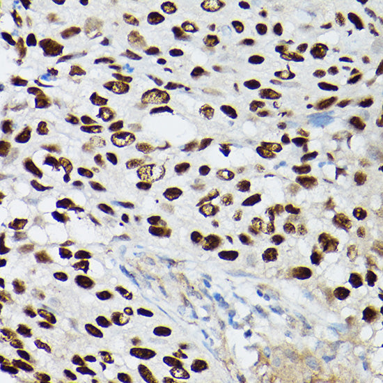 p63 Rabbit mAb