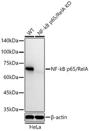 [KO Validated] NF-kB p65/RelA Rabbit mAb