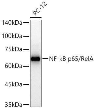 [KO Validated] NF-kB p65/RelA Rabbit mAb
