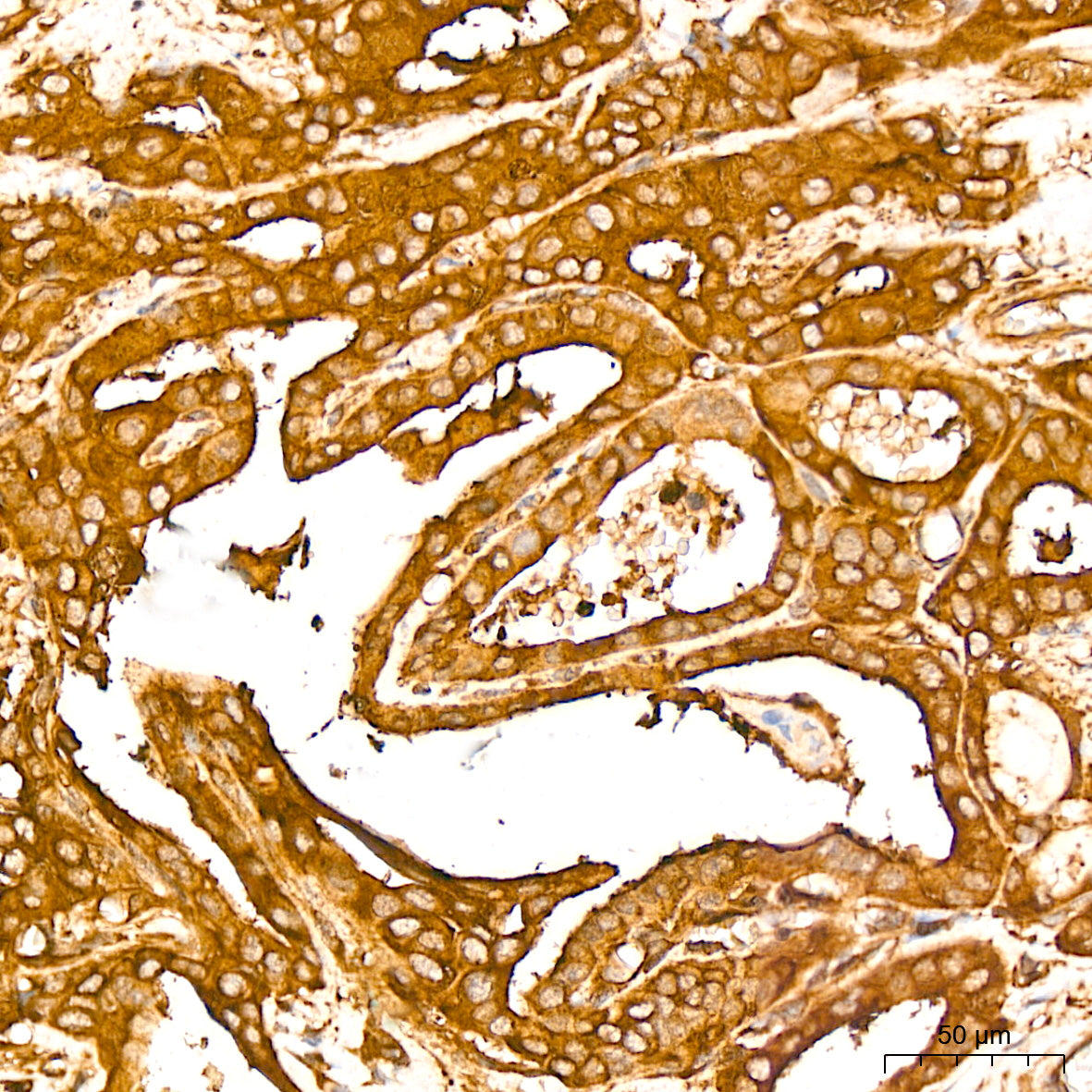 [KO Validated] NF-kB p65/RelA Rabbit mAb
