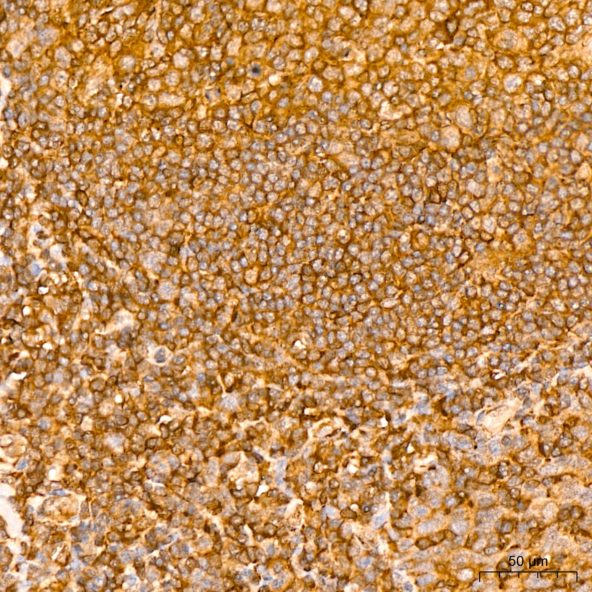 [KO Validated] NF-kB p65/RelA Rabbit mAb