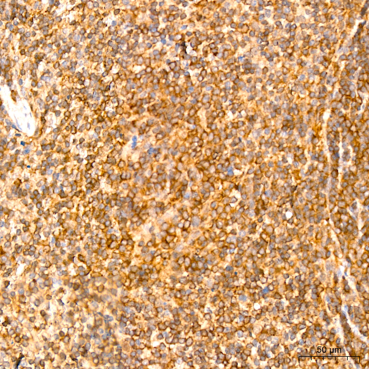 [KO Validated] NF-kB p65/RelA Rabbit mAb