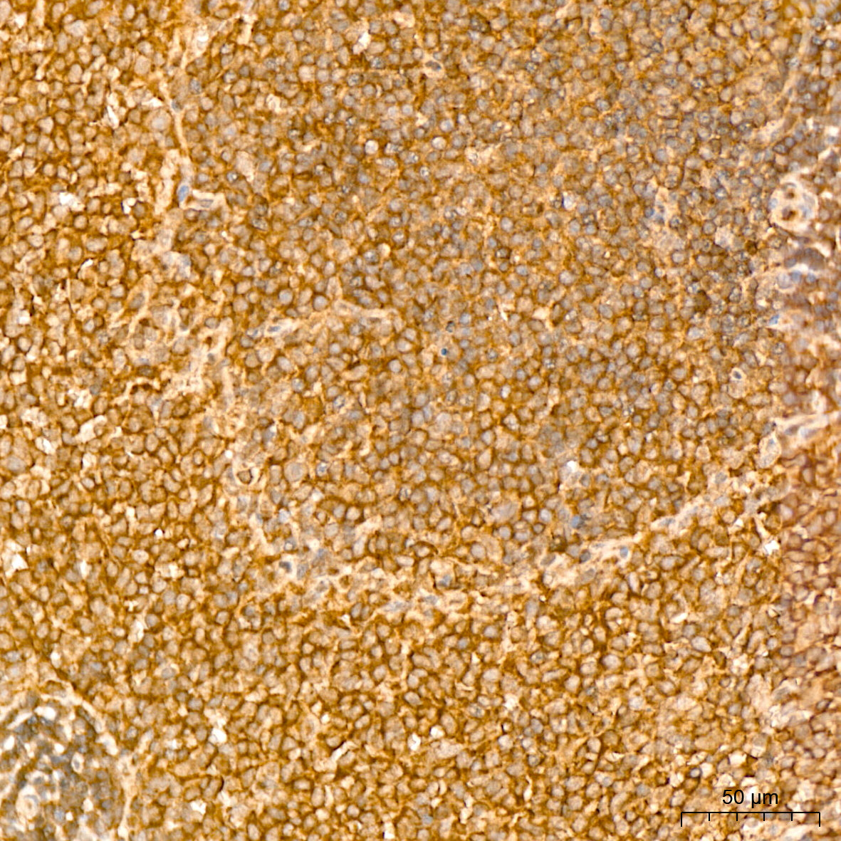 [KO Validated] NF-kB p65/RelA Rabbit mAb