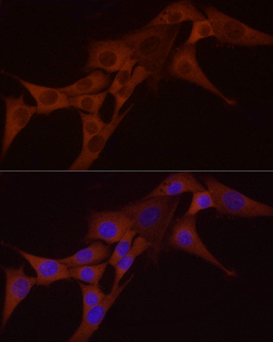 [KO Validated] NF-kB p65/RelA Rabbit mAb