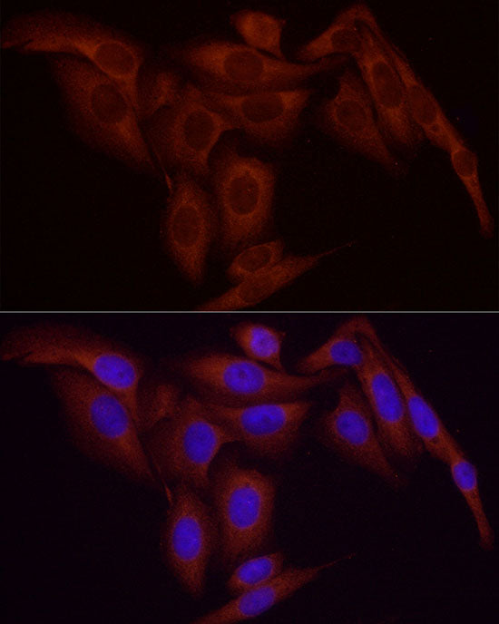 [KO Validated] NF-kB p65/RelA Rabbit mAb