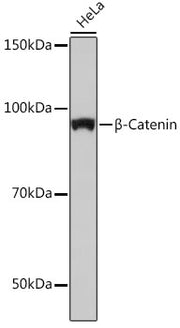[KO Validated] β-Catenin Rabbit mAb