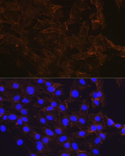 [KO Validated] β-Catenin Rabbit mAb