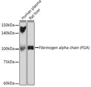 Fibrinogen alpha chain (FGA) Rabbit mAb