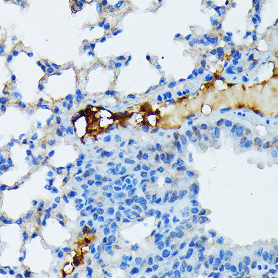 Fibrinogen alpha chain (FGA) Rabbit mAb