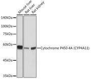 Cytochrome P450 4A (CYP4A11) Rabbit mAb