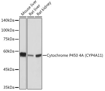 Cytochrome P450 4A (CYP4A11) Rabbit mAb