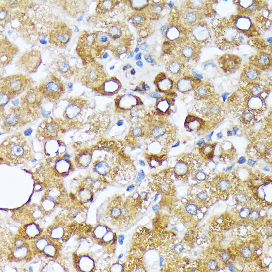 Cytochrome P450 4A (CYP4A11) Rabbit mAb
