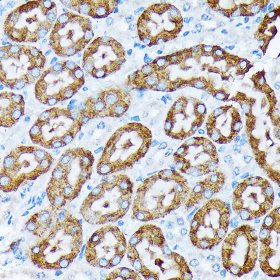 Cytochrome P450 4A (CYP4A11) Rabbit mAb