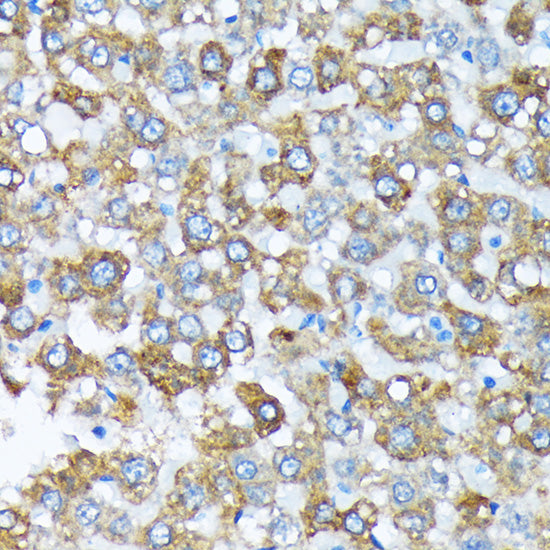 Cytochrome P450 4A (CYP4A11) Rabbit mAb