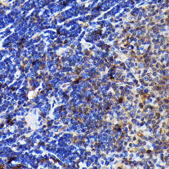 Caspase-3 Rabbit mAb