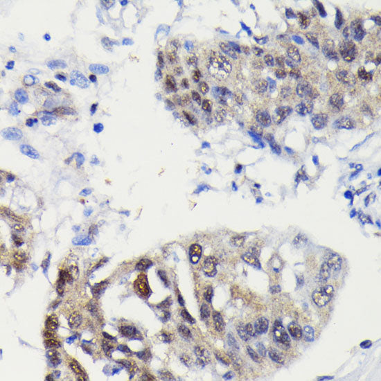 Caspase-3 Rabbit mAb