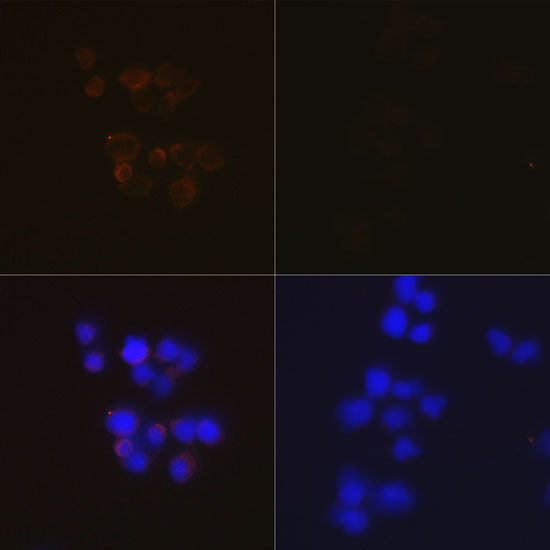 Caspase-3 Rabbit mAb