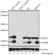 [KD Validated] LC3B Rabbit mAb