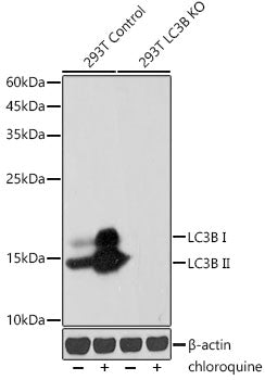 [KD Validated] LC3B Rabbit mAb