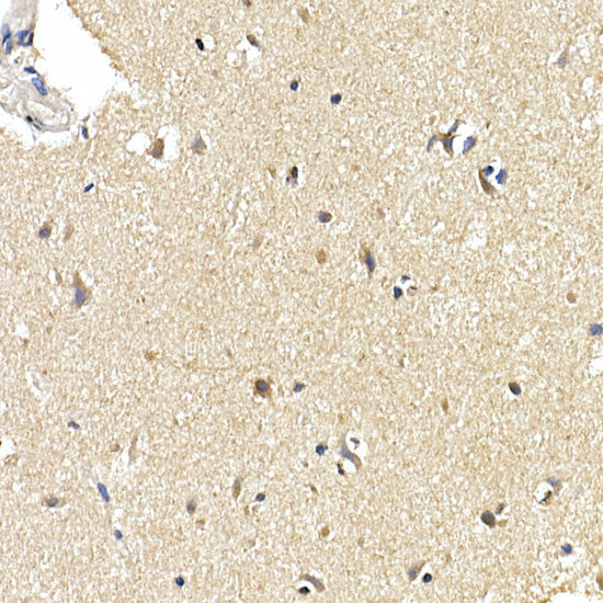 [KD Validated] LC3B Rabbit mAb