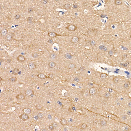 [KD Validated] LC3B Rabbit mAb