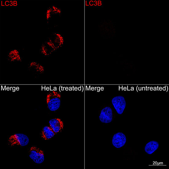 [KD Validated] LC3B Rabbit mAb