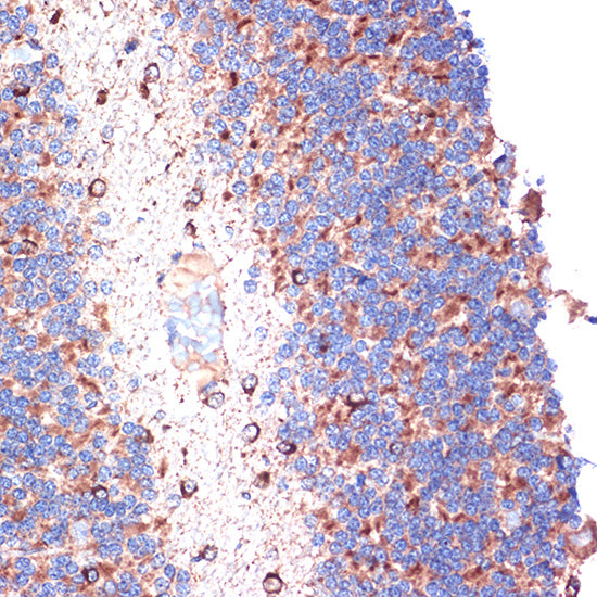 [KO Validated] TTC11/FIS1 Rabbit mAb