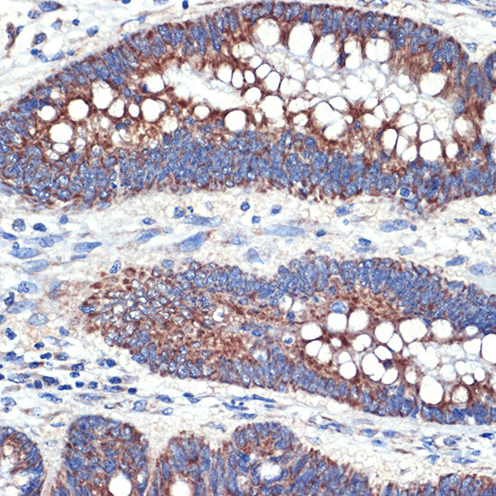 [KO Validated] TTC11/FIS1 Rabbit mAb