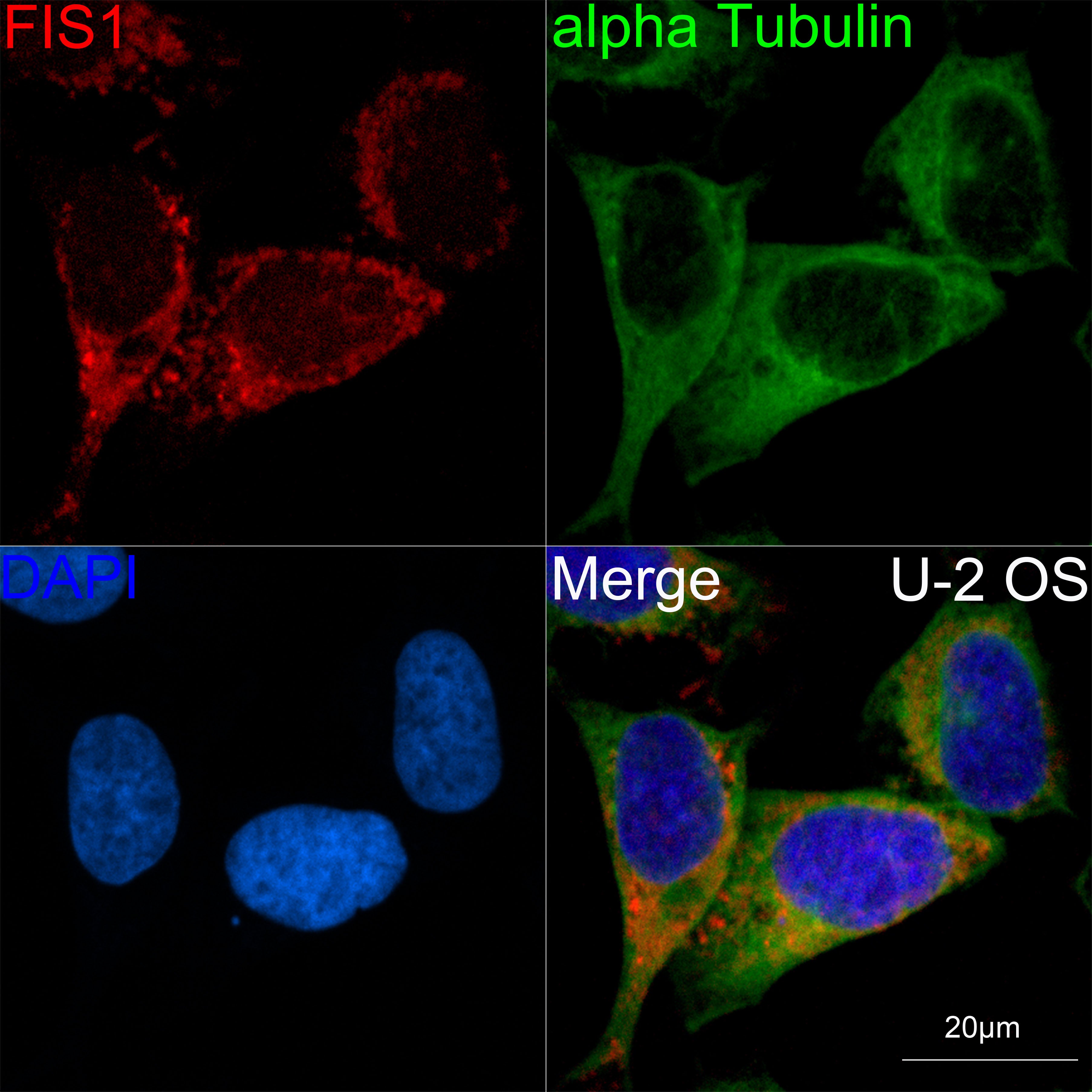 [KO Validated] TTC11/FIS1 Rabbit mAb