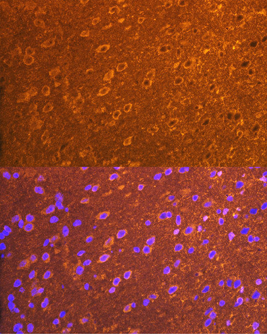 PSD93/chapsyn-110/DLG2 Rabbit mAb