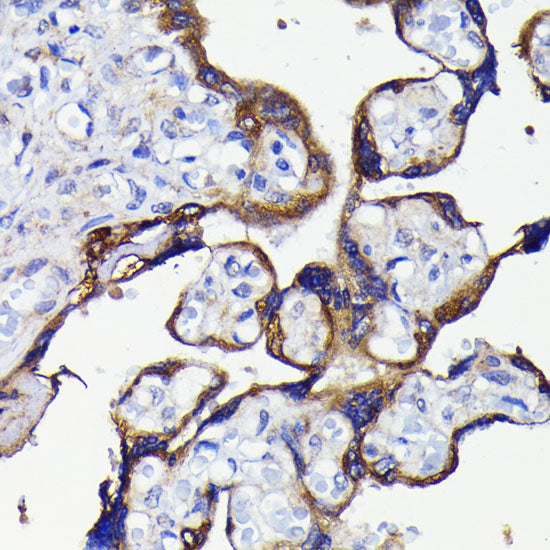 [KO Validated] ATG5 Rabbit mAb