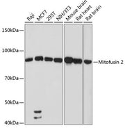 Mitofusin 2 Rabbit mAb