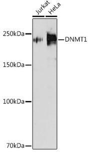 [KD Validated] DNMT1 Rabbit mAb