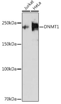 [KD Validated] DNMT1 Rabbit mAb