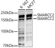 SMARCC2 Rabbit pAb