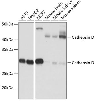 Cathepsin D Rabbit mAb