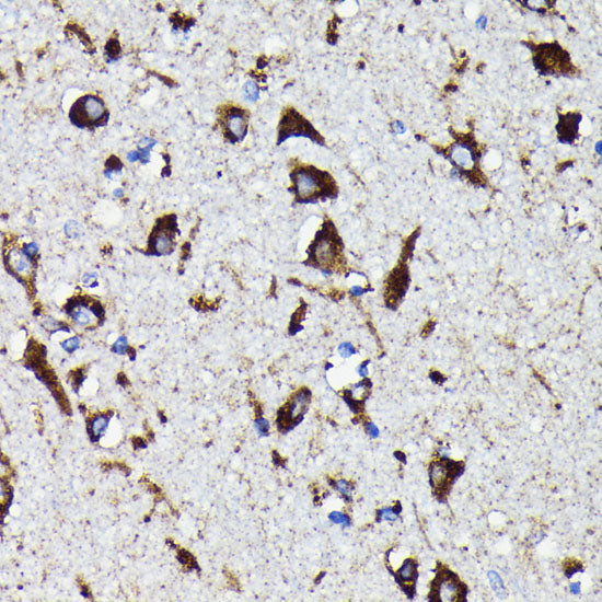 Cathepsin D Rabbit mAb