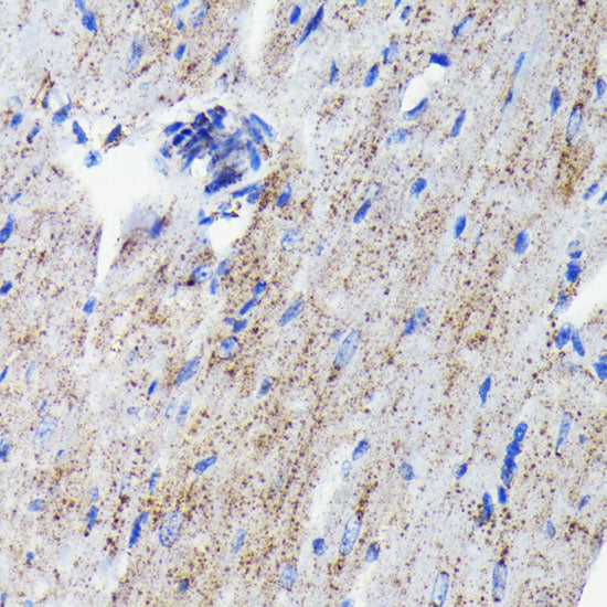 Cathepsin D Rabbit mAb