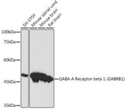 GABA A Receptor beta 1 (GABRB1) Rabbit mAb