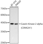[KD Validated] Casein Kinase 2 alpha (CSNK2A1) Rabbit mAb